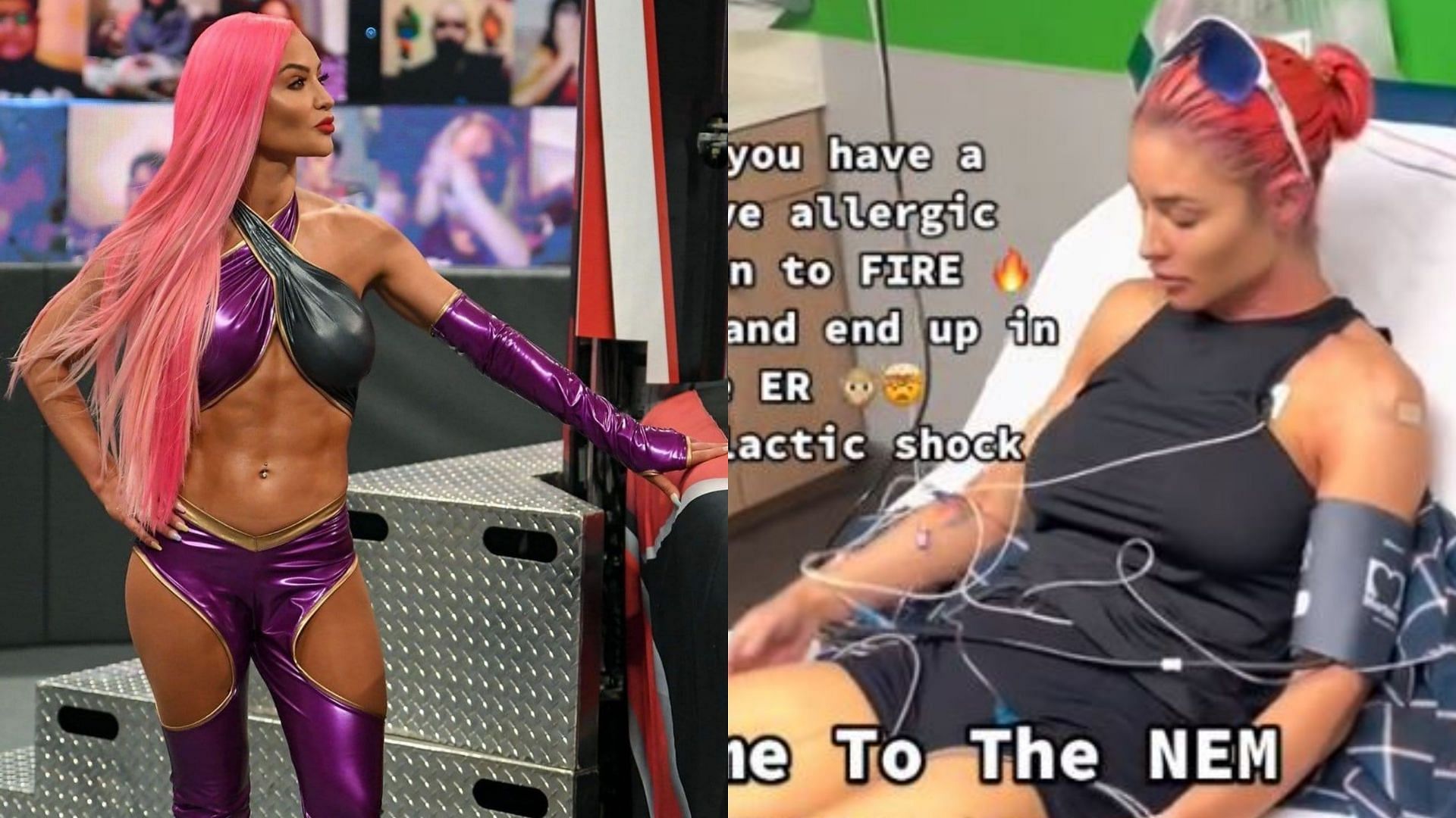 Eva Marie had to rush to the ER due to a bad allergic reaction