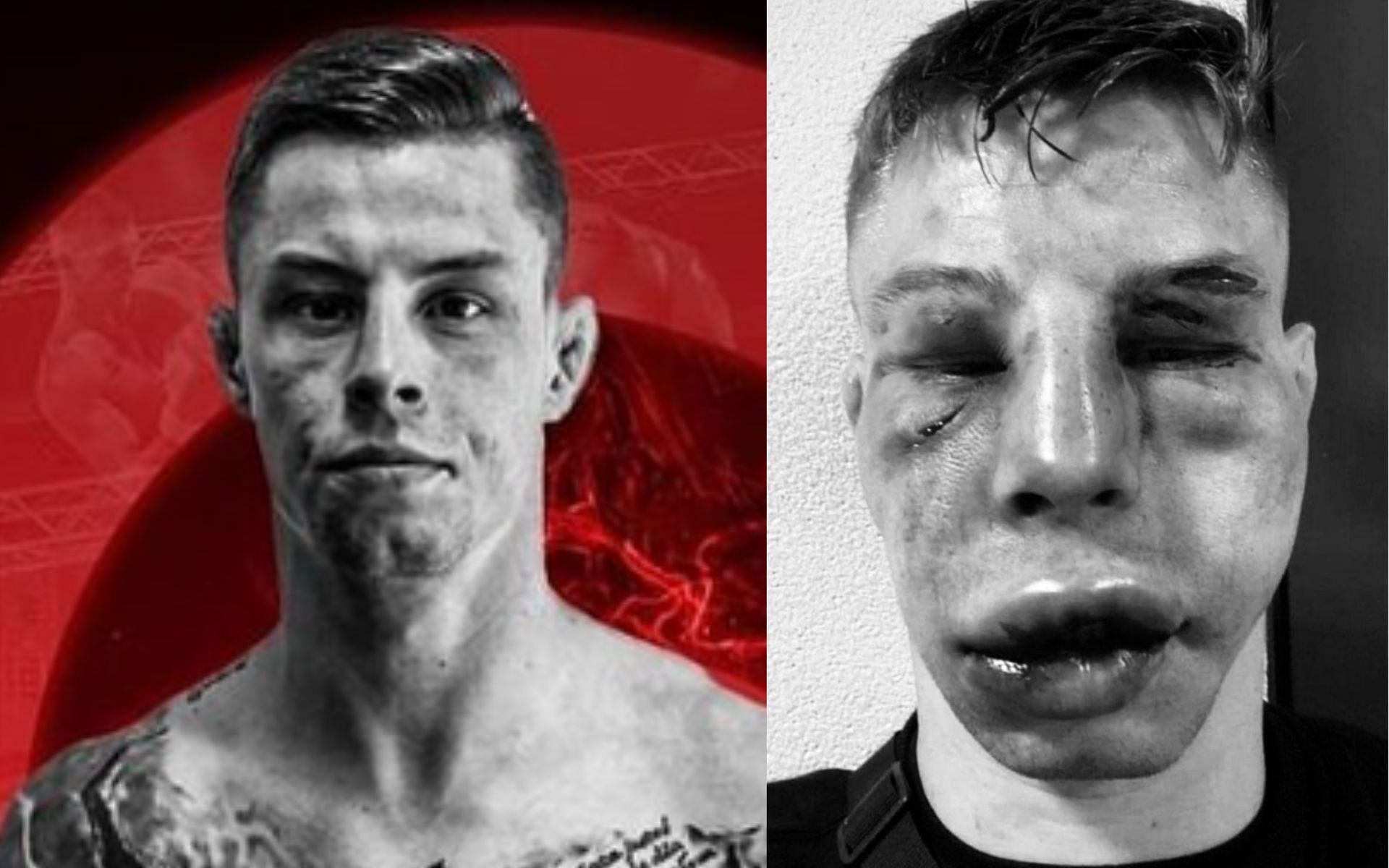 Krystian Blezien before and after the fight. [Images courtesy: left image from Instagram @krystianblezienmma and right image from Twitter @Sebinho93x]