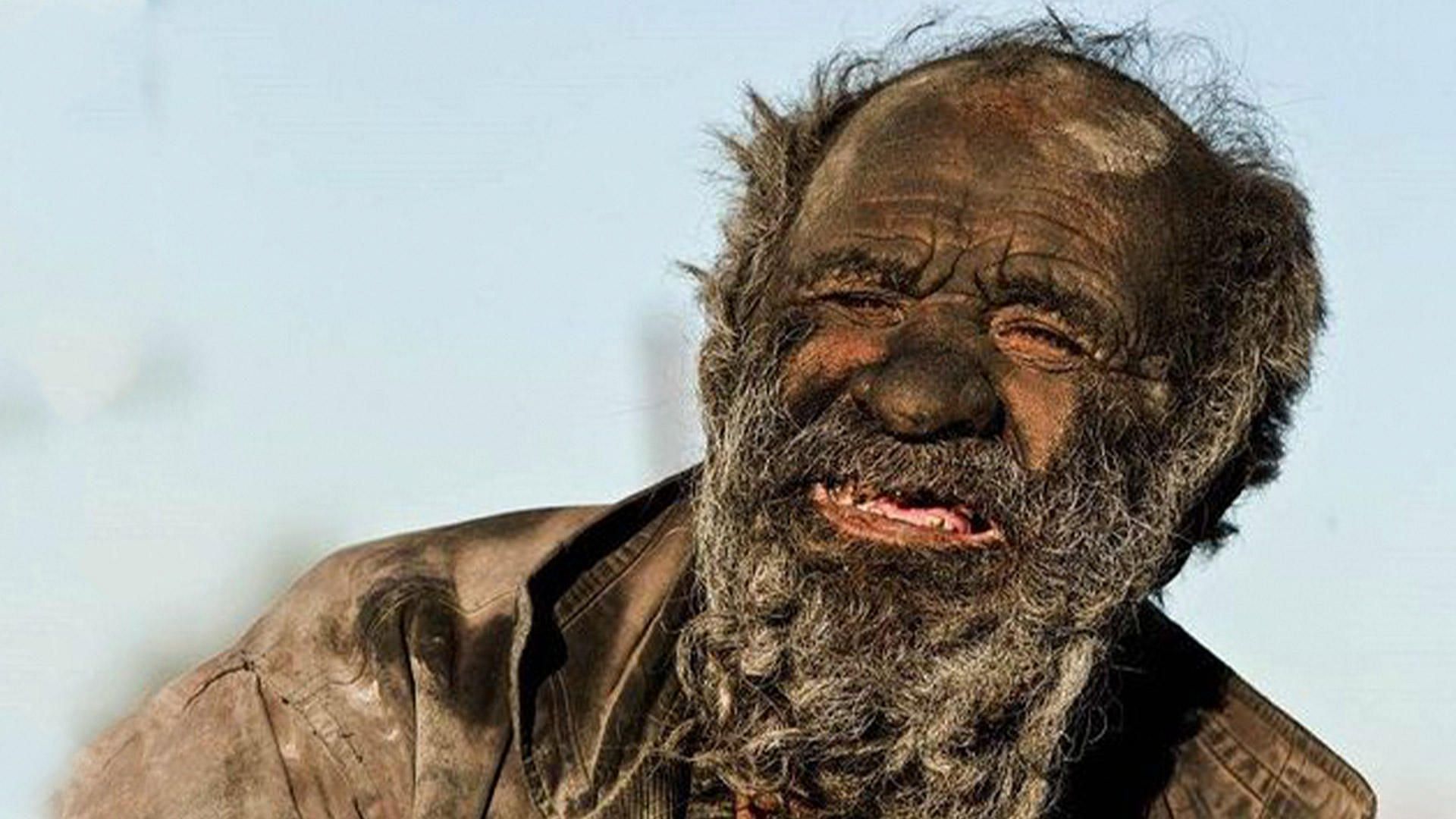 World&#039;s dirtiest man dies at 94 (Image credits: APF via Getty Images)