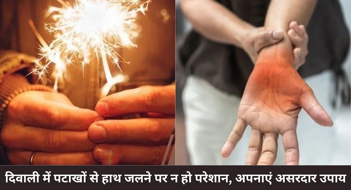 दिवाली में पटाखों से हाथ जलने पर न हो परेशान, अपनाएं असरदार उपाय 