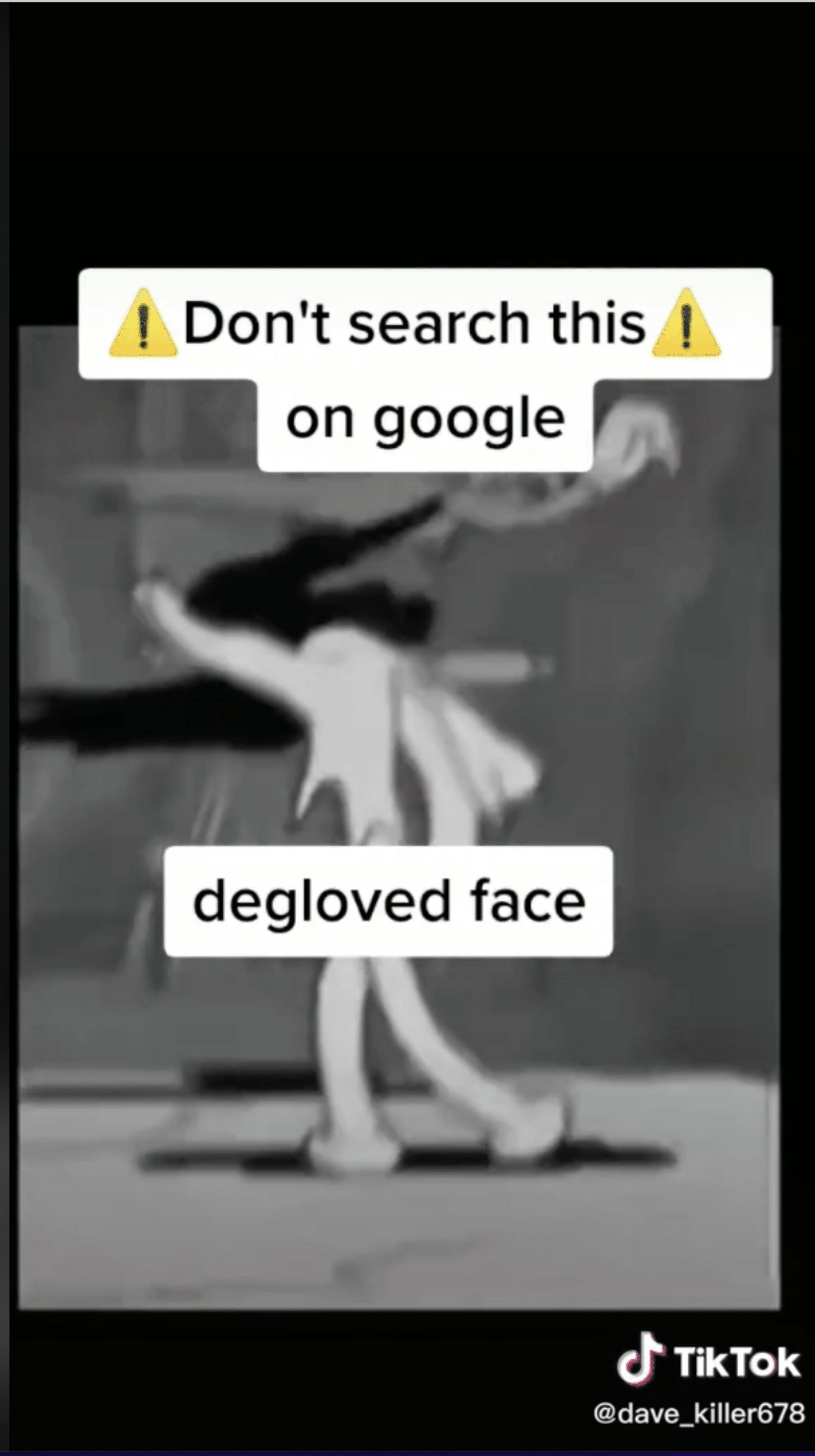 Social media users warn the netizens not to search for degloved face videos and images as some have found them to be super traumatizing. (Image via TikTok)