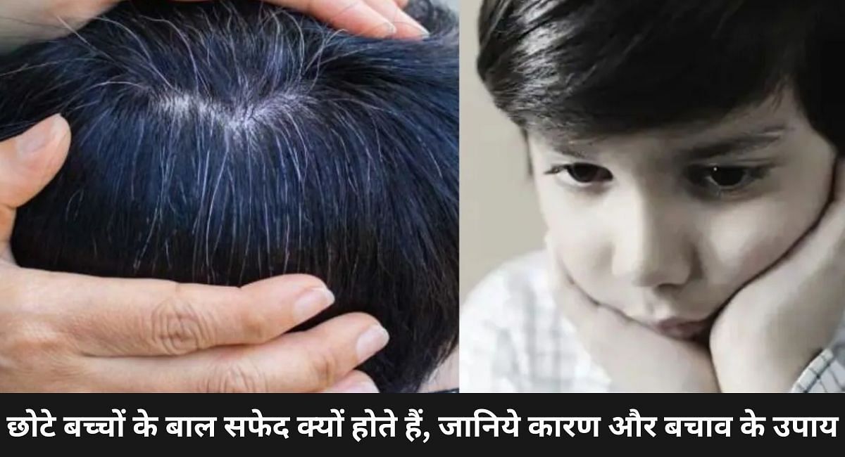 छोटे बच्चों के बाल सफेद क्यों होते हैं, जानिये कारण और बचाव के उपाय - Why  young children have white hair, know the reasons and preventive measures In  Hindi