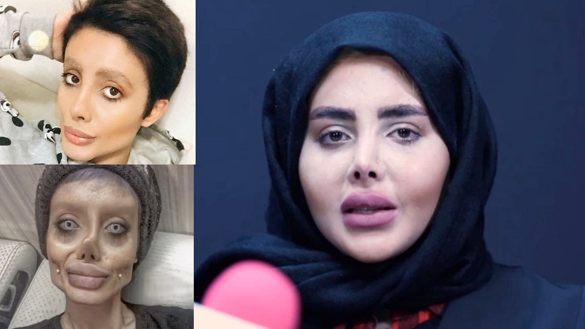 Zombie Angelina Jolie Real Face Revealed As Iranian Woman Gets Released From Jail Amid Hijab