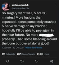 Adriana Chechik updated her fans (Image via Twitter)