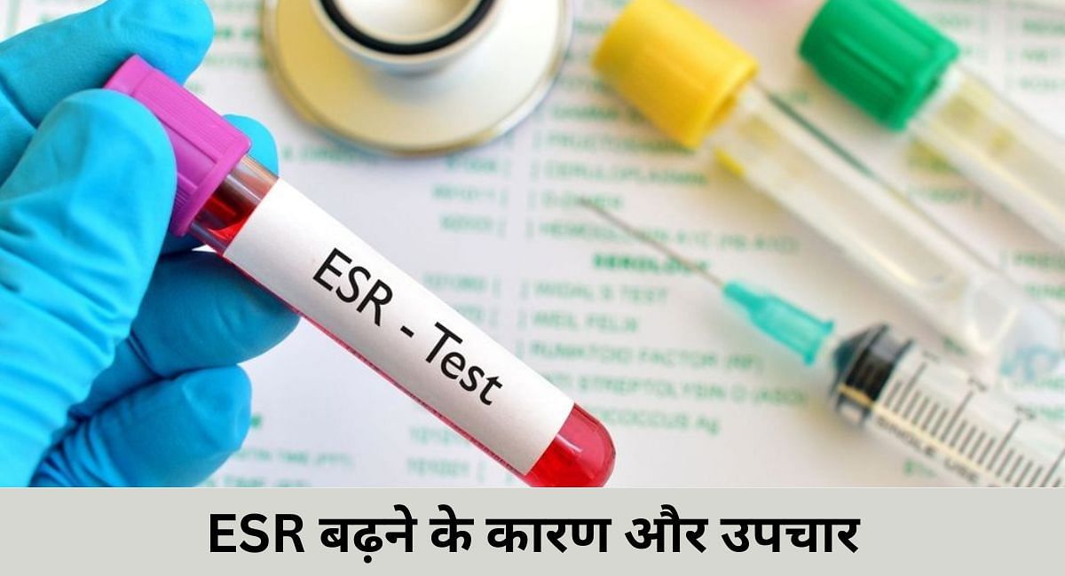 ESR बढ़ने के कारण और उपचार ( फोटो - sportskeeda Hindi)