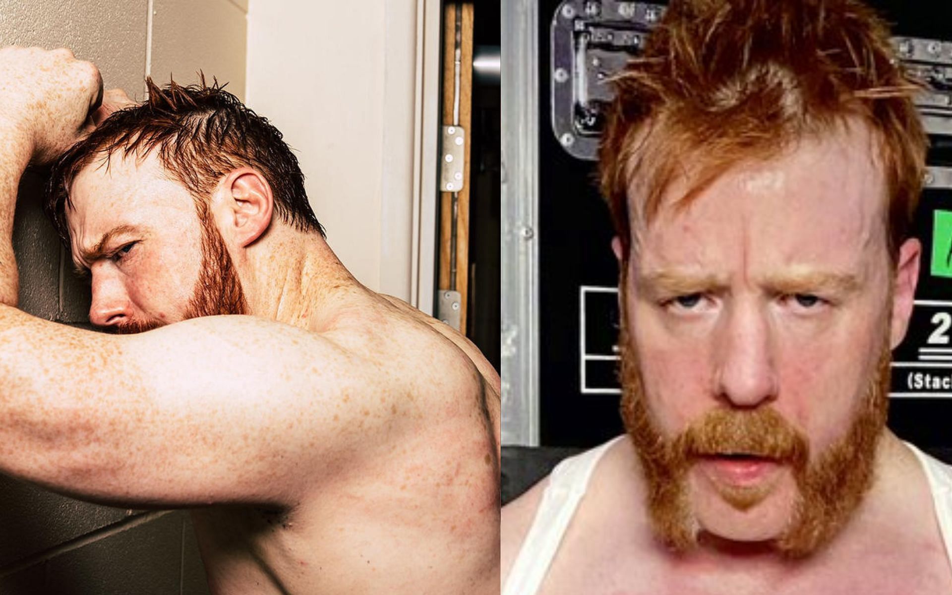 Sheamus suffered a lot during this week