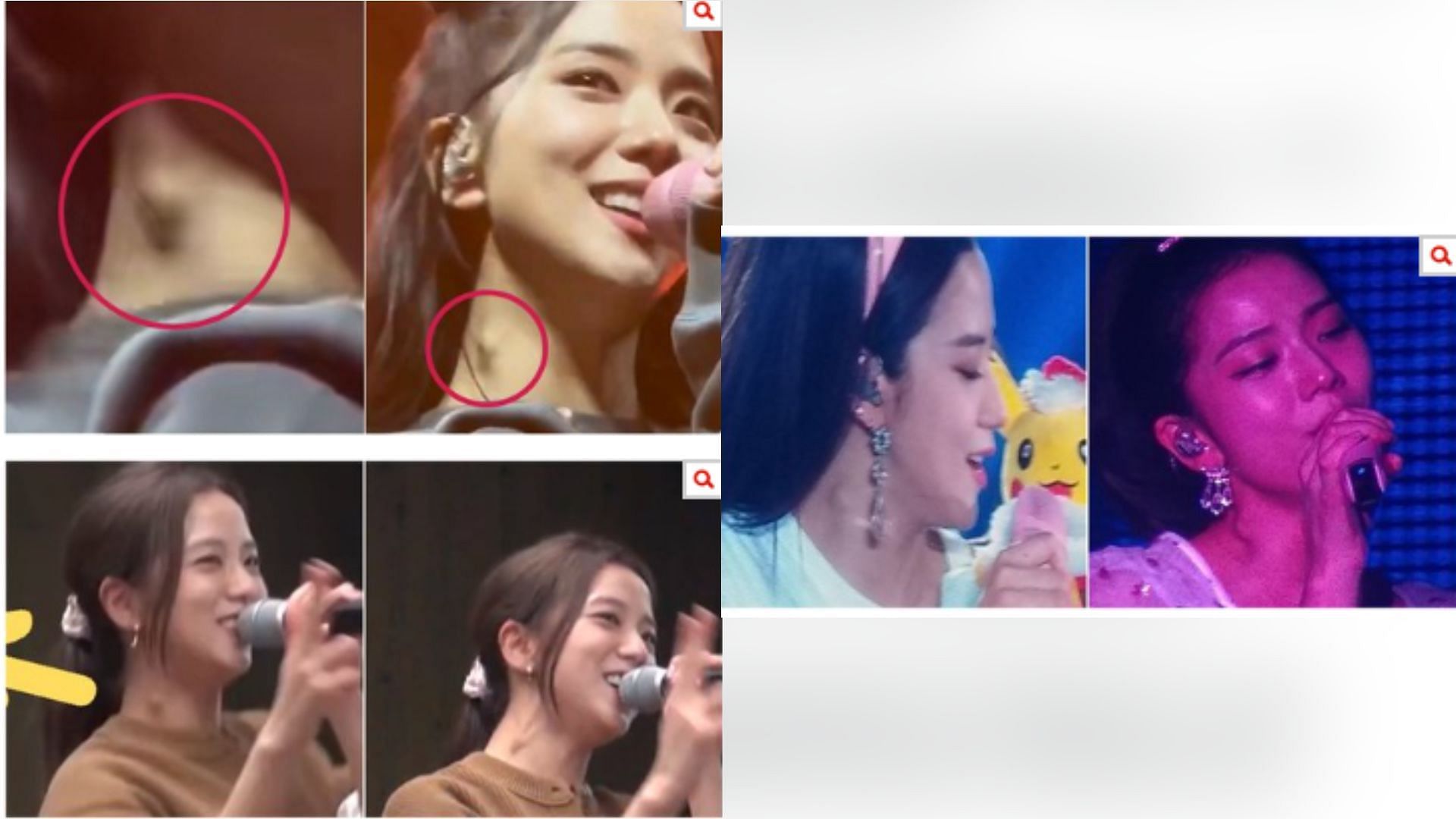 Screenshots of BLACKPINK&#039;s member Jisoo&#039;s current and past occurrences of swollen lymph nodes (Image via pannnate)