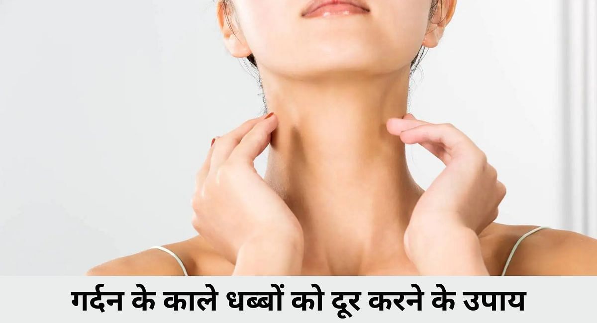 गर्दन के काले धब्बों को दूर करने के उपाय 