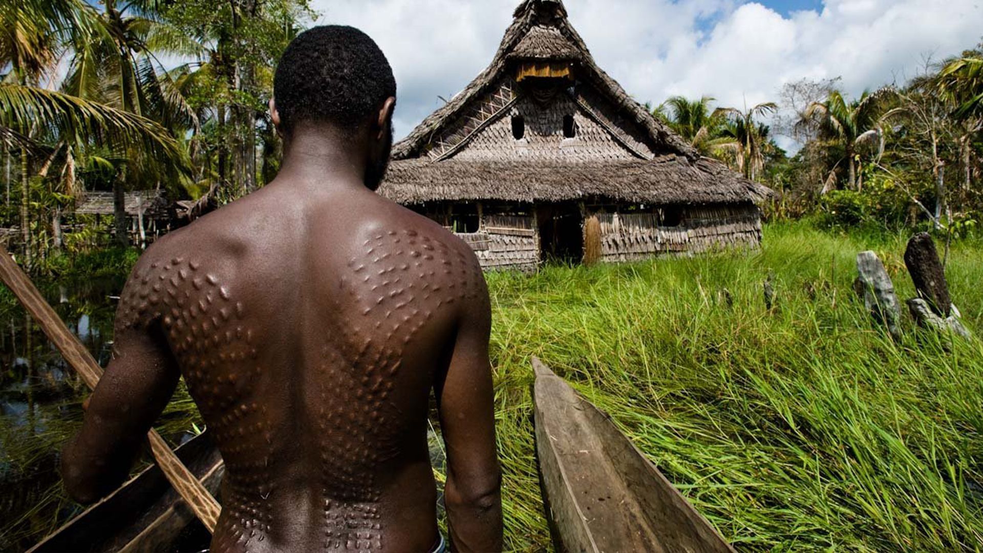 A man with crocodile scars (Image via Getty)