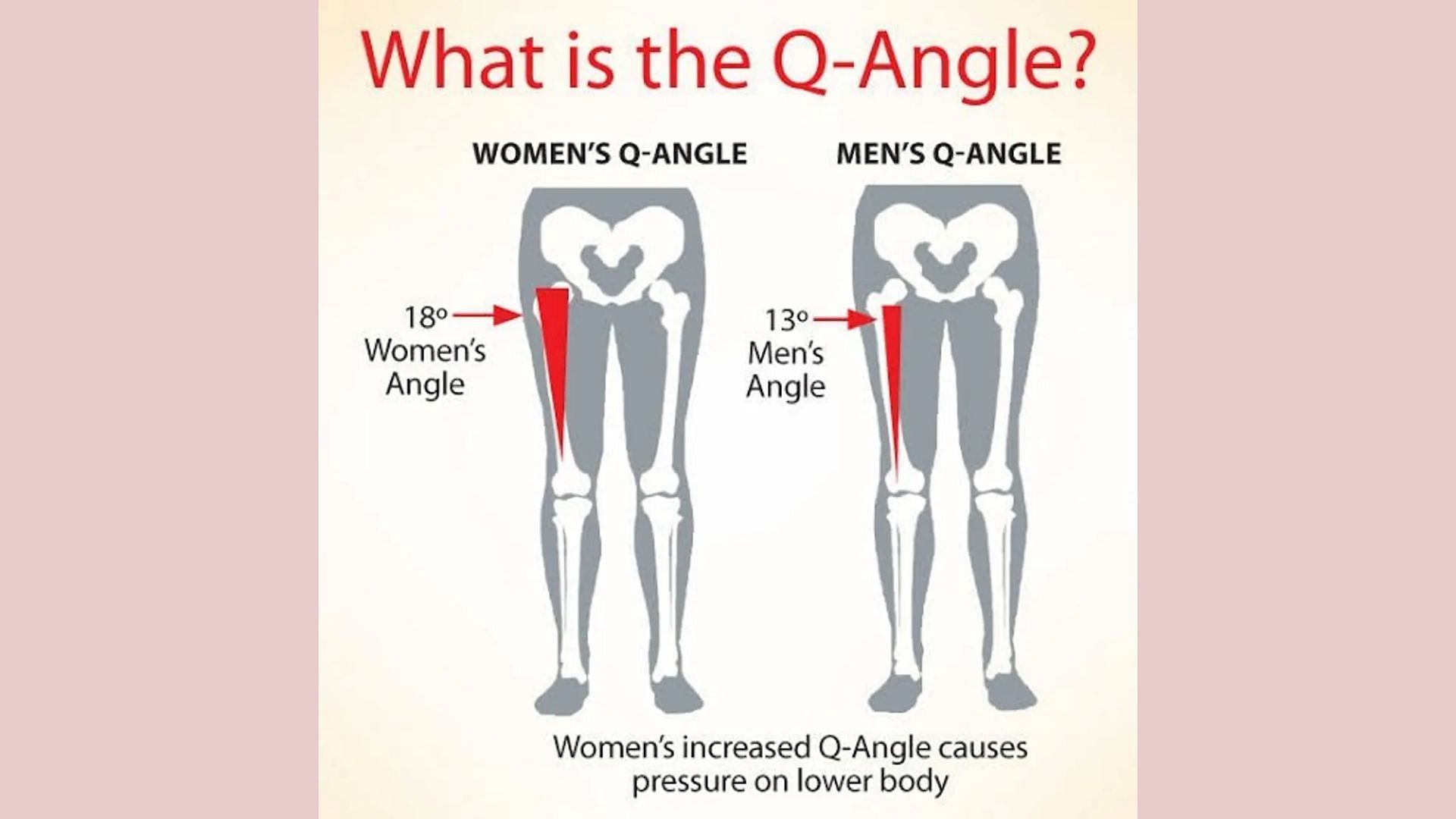 Q angle is important in choosing footwear (Image via @heellover/ Quora)