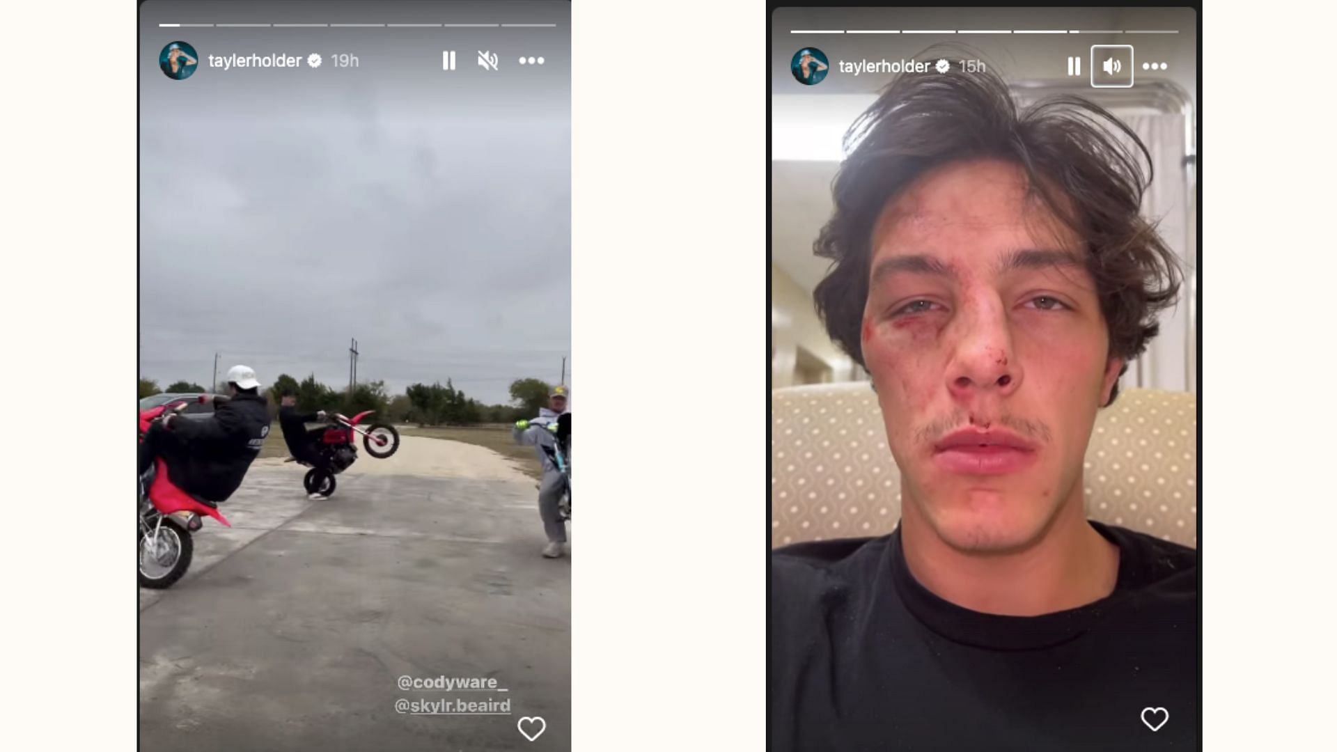 Tayler Holder posted injuries shortly after riding dirt bikes (image via Instagram)