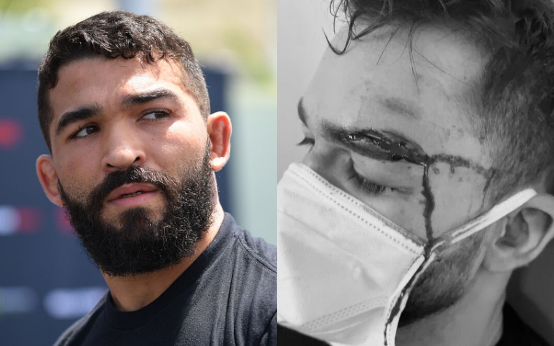 Patricio Pitbull (left), Patricky Pitbull (right. Image credit: @PatricioPitbull on Twitter)