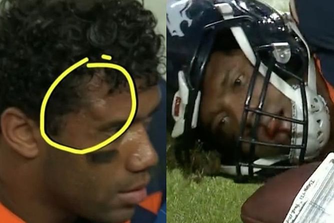 What happened to Russell Wilson? Broncos QB suffer concussion after hitting ground headfirst