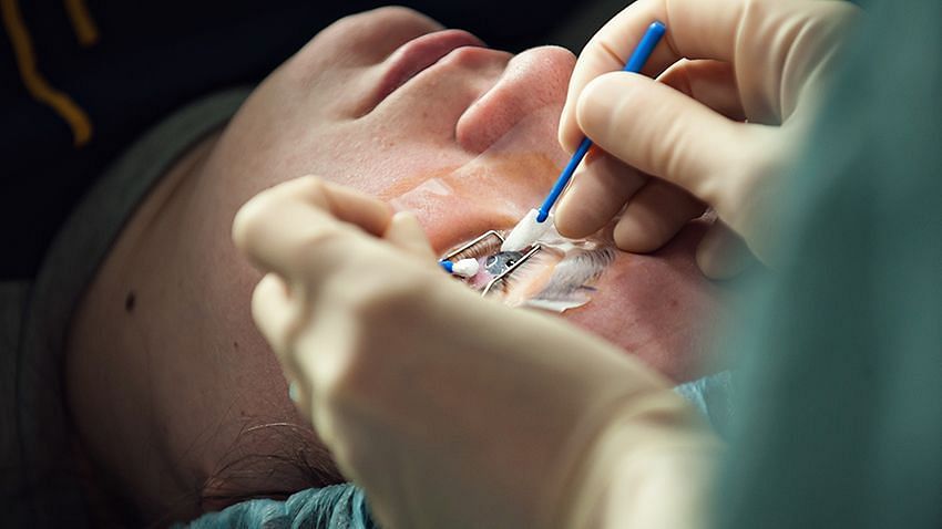Is Lasik safe for all patients? Details and complications suggested by FDA explored. (Image via Getty Images)