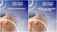 What is scapular winging? (Image via Instagram @smartphysio_uk)