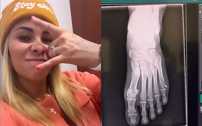 Former UFC star Paige VanZant suffers three broken bones in her foot, unlikely to return to action anytime soon