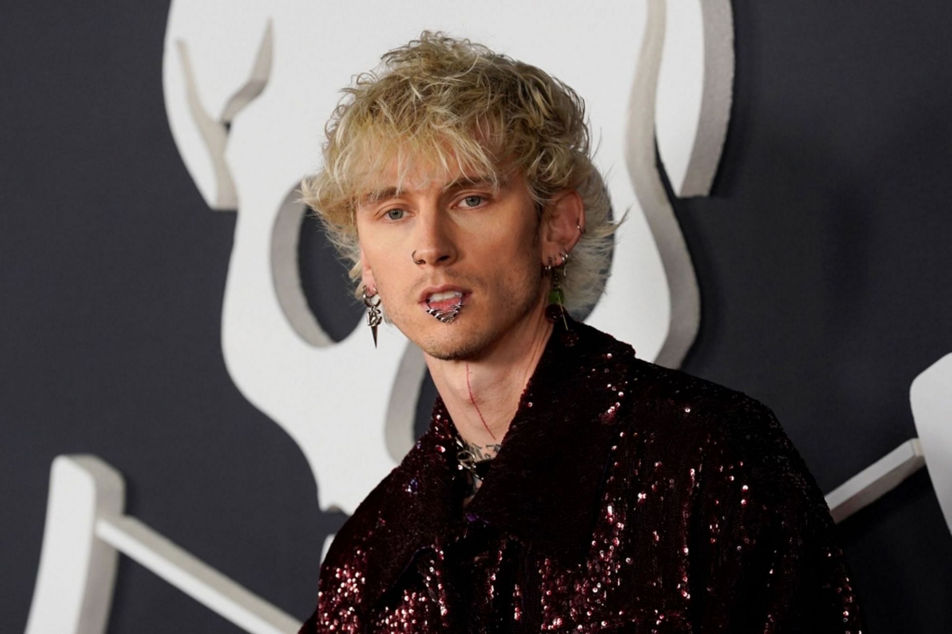 Machine Gun Kelly shows leeches on his stomach in Instagram story (Image via Getty Images)