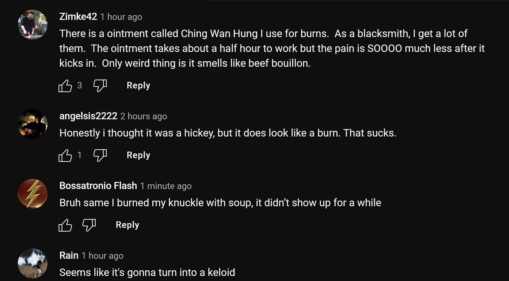 Fans in the YouTube comments section reacting to the streamer&#039;s burn scar (Image via Jeru TV/YouTube)