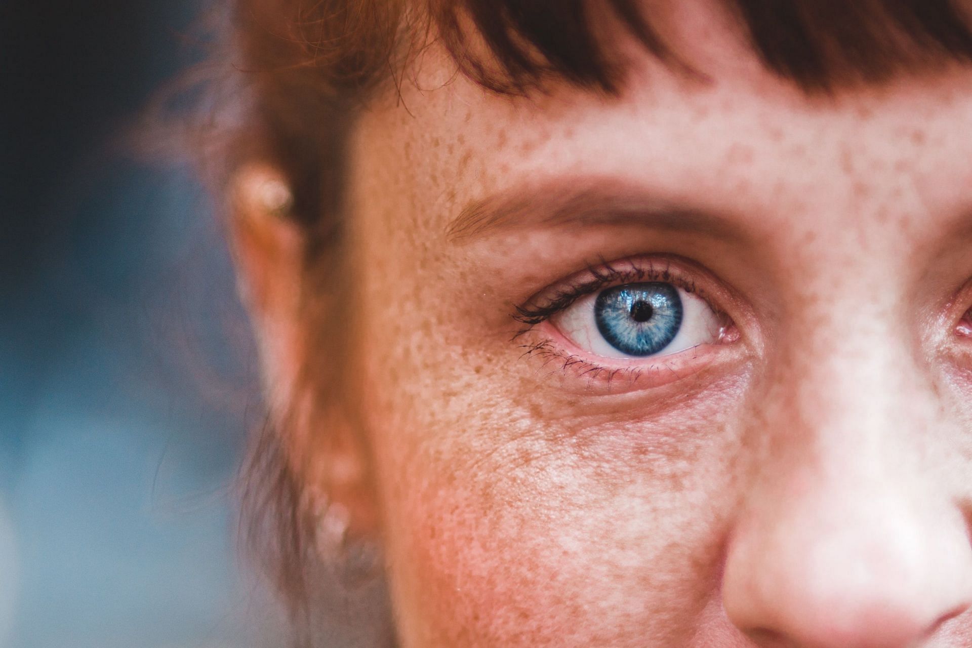 Blue light therapy is used for treatment of various skin ailments (Image via Pexels @Erik Mclean)