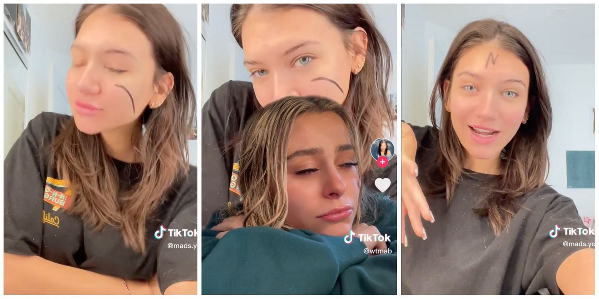 Did Mads Lewis really mock Annie, The Scar Girl in her recent video? Details and netizens reactions explored. (Image via TikTok)