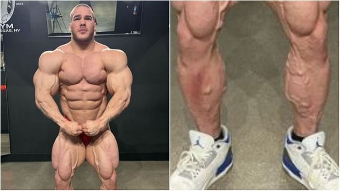 Has Nick Walker’s varicose veins diminished ahead of the 2023 Arnold Classic?