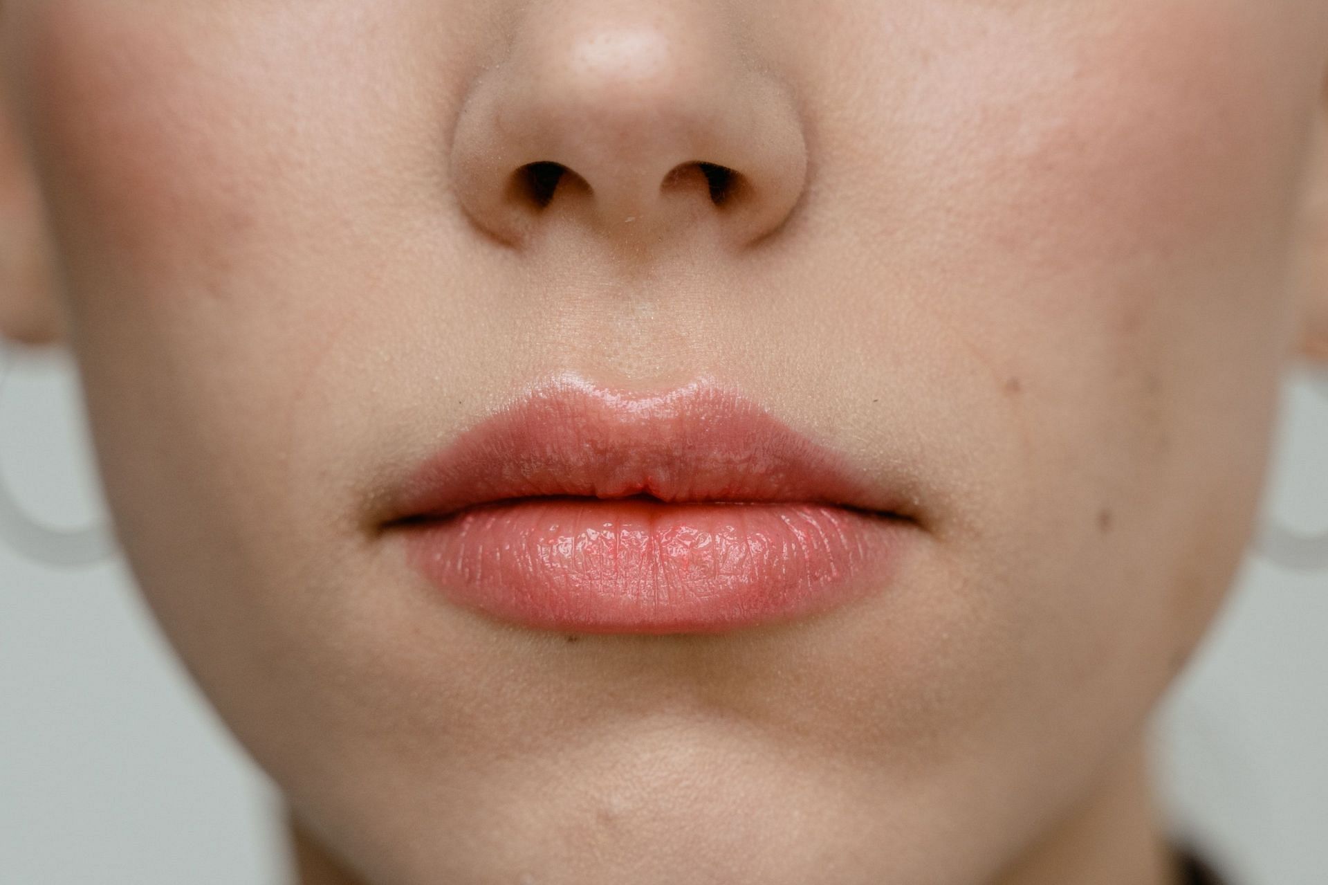 Cold sores are caused by a specific kind of virus called herpes. (Image via Pexels / Mart Production)