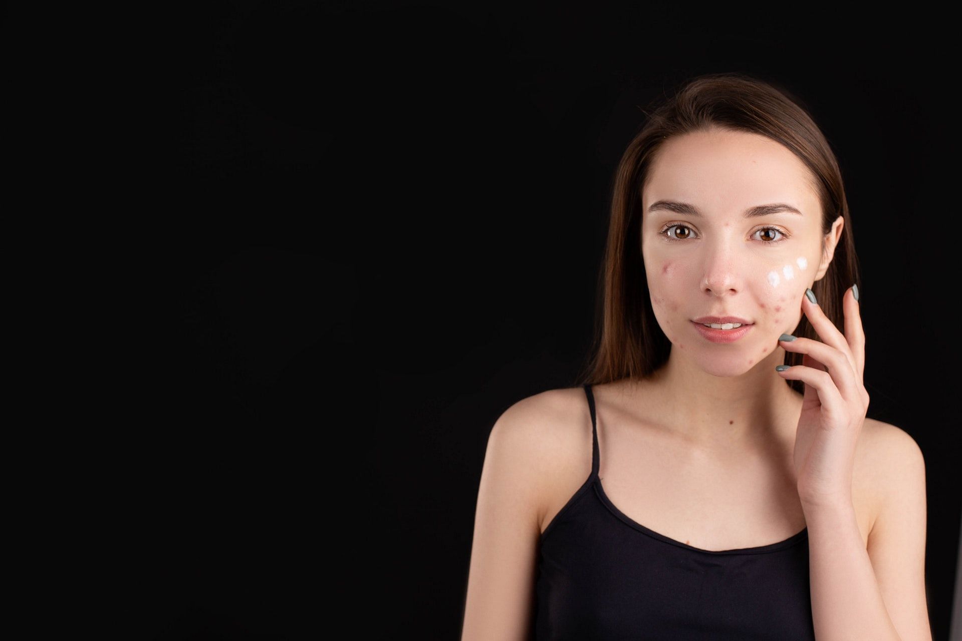 Tips for removing dark spots on face. (Photo via Pexels/Anna Nekrashevich)
