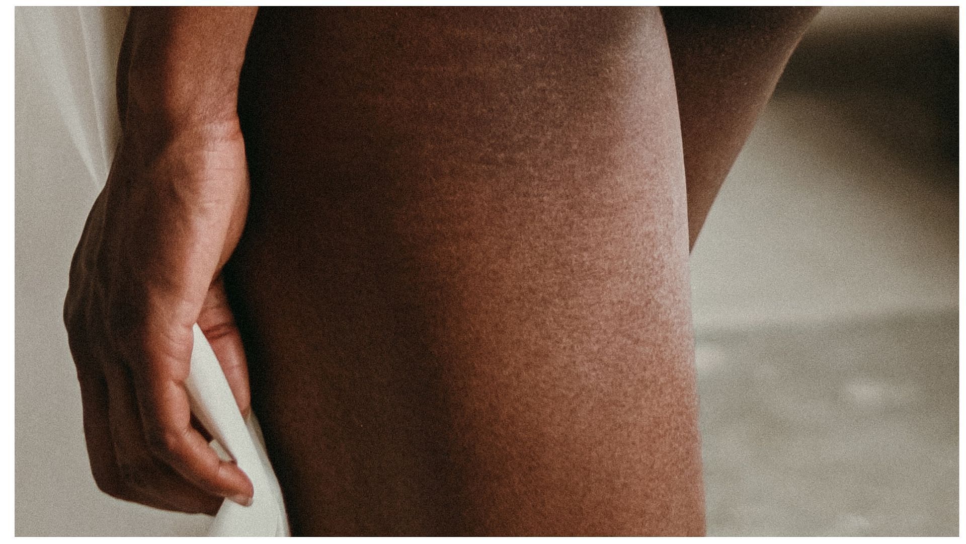 Stretch mark, however, typically never truly go away altogether. (Image via Unsplash/Monika Kozub)