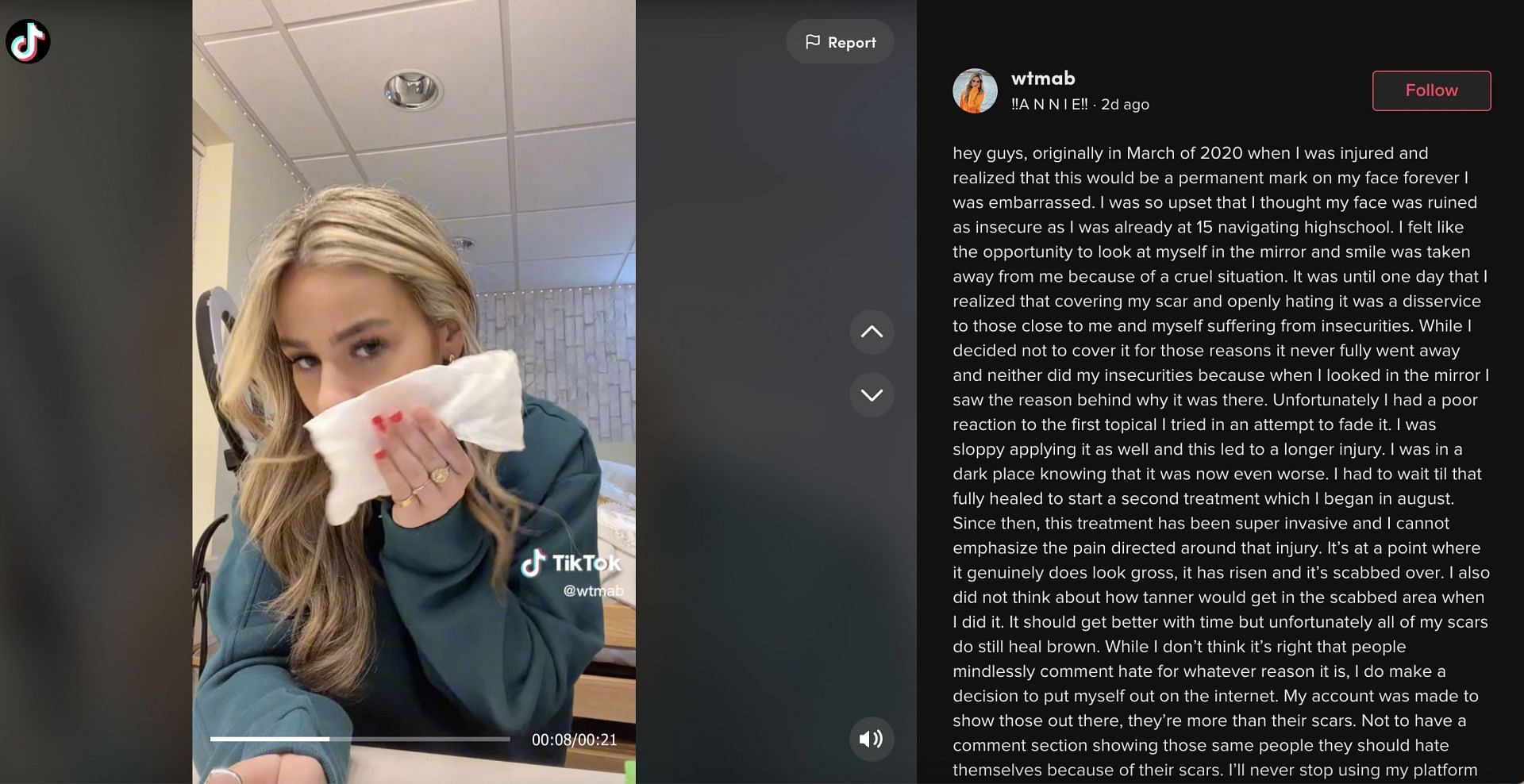 Annie uploaded a video where she tried to wipe off her scar; TikToker shared backstory of the scar, and how she got it. (Image via TikTok)