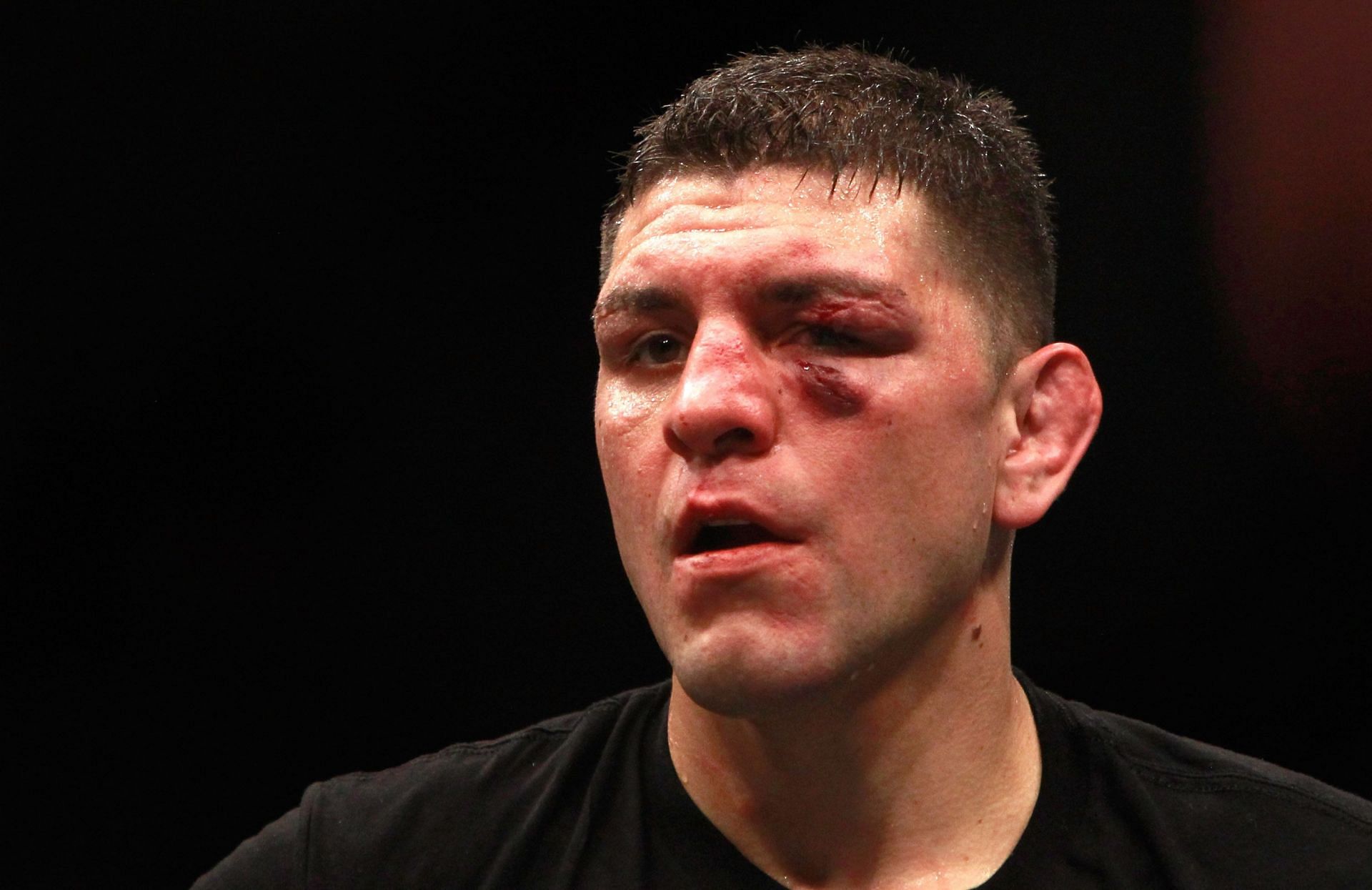 Nick Diaz's star power has made him a viable headliner despite his lack of victories