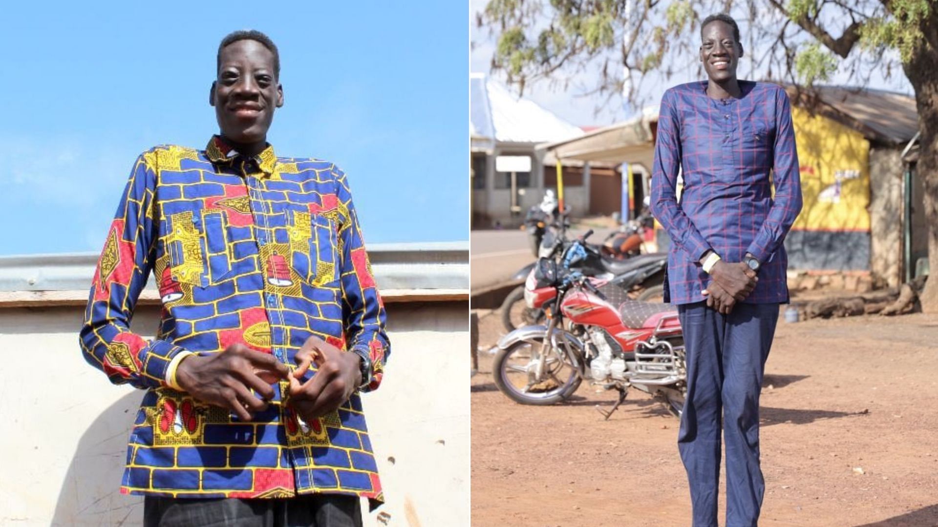 Ghana-native Sulemana Abdul Samed, who has gigantism, might snatch the world