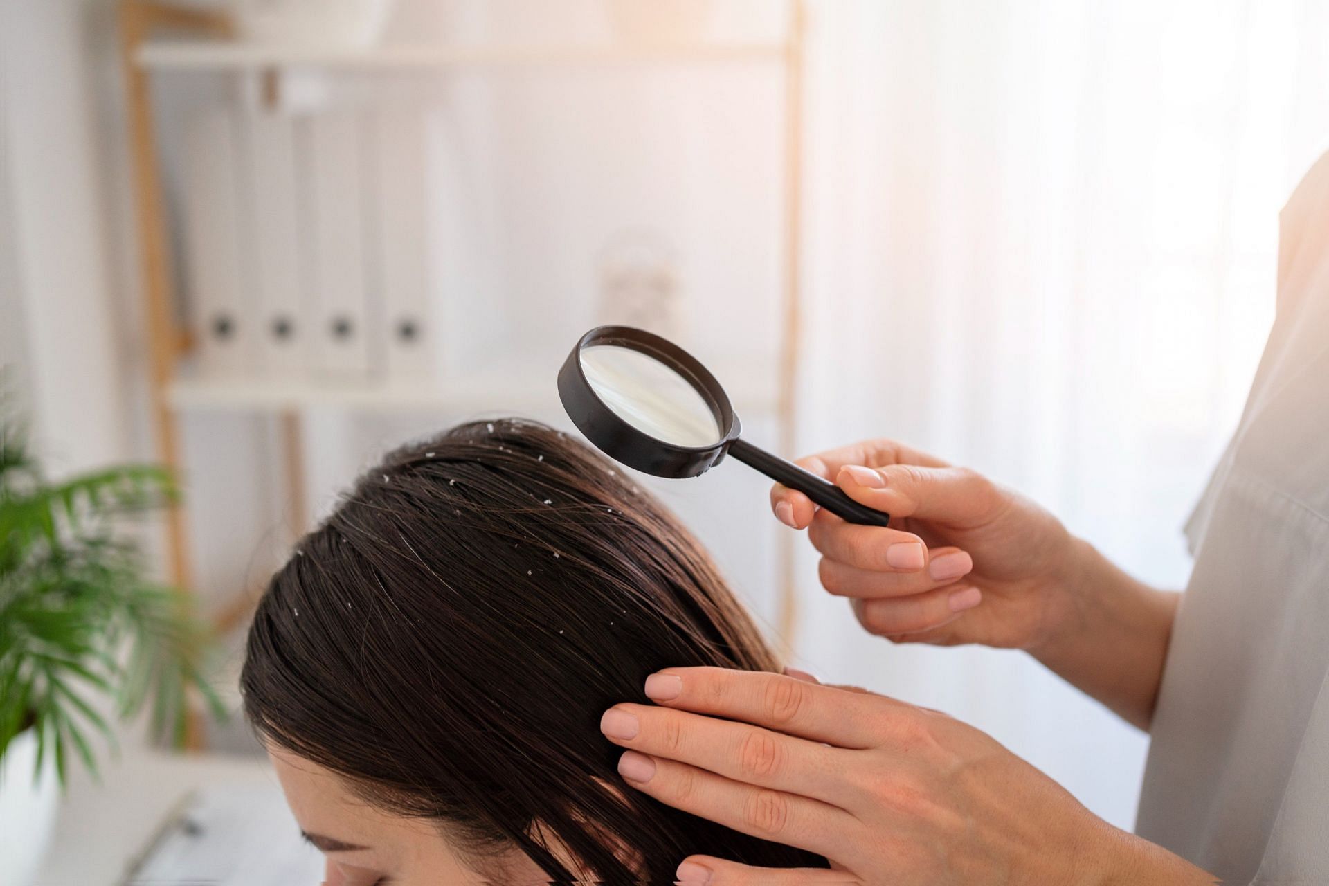 While treatment for scalp eczema is possible, prevention is always better. (Image via Freepik/ Freepik)
