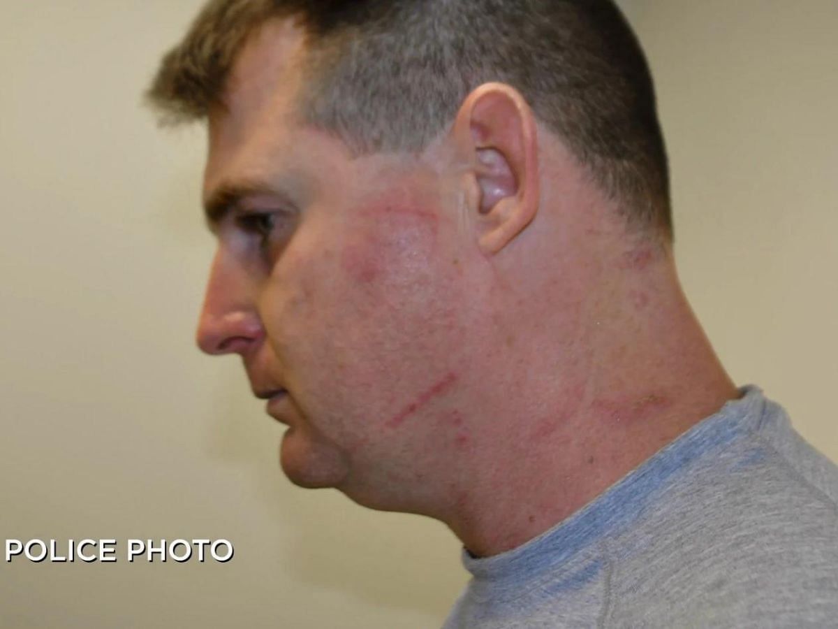 Visible scratches were seen on the face and neck of Roger Holland after wife&#039;s death (Image via The Cinemaholic)