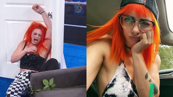 [PHOTO] Gigi Dolin provides an update on the gruesome bruise on her face