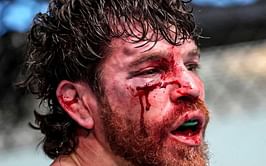Jim Miller updates fans on traumatic cataract injury suffered during UFC Vegas 69 defeat