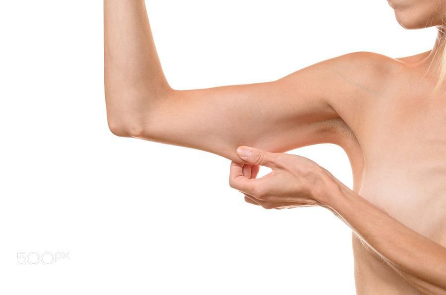 Arm flab can exist in the slimmest of people, and it is usually because of saggy triceps muscles (Image via Flickr)