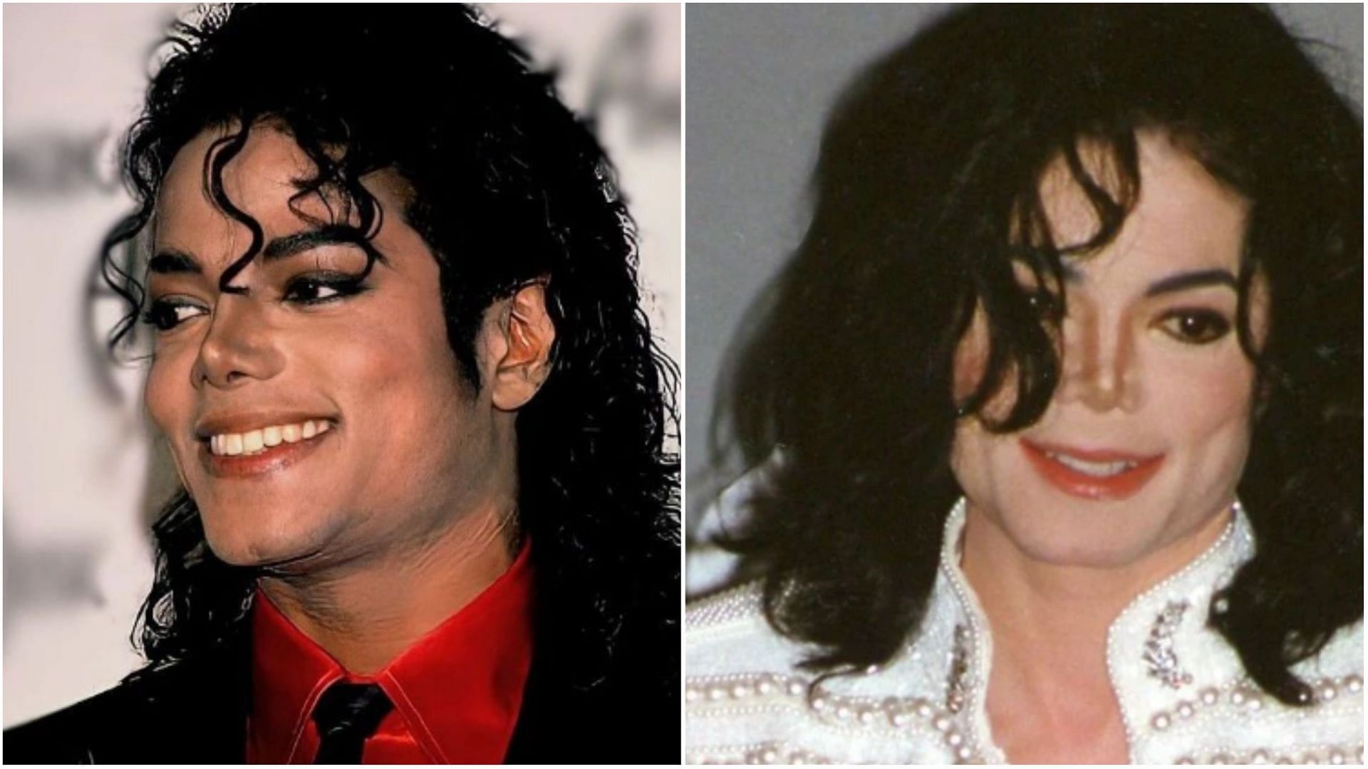 Michael Jackson explained his skin disorder after claims he was bleaching  it to become white