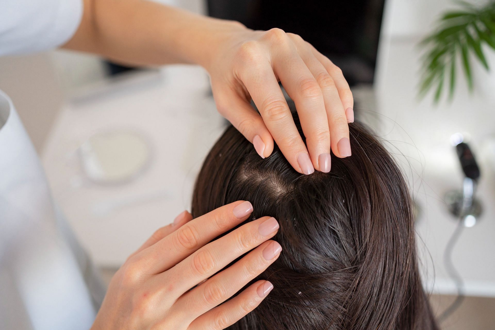 Treatment for scalp eczema generally also involves management with flare ups. (Image via Freepik/ Freepik)