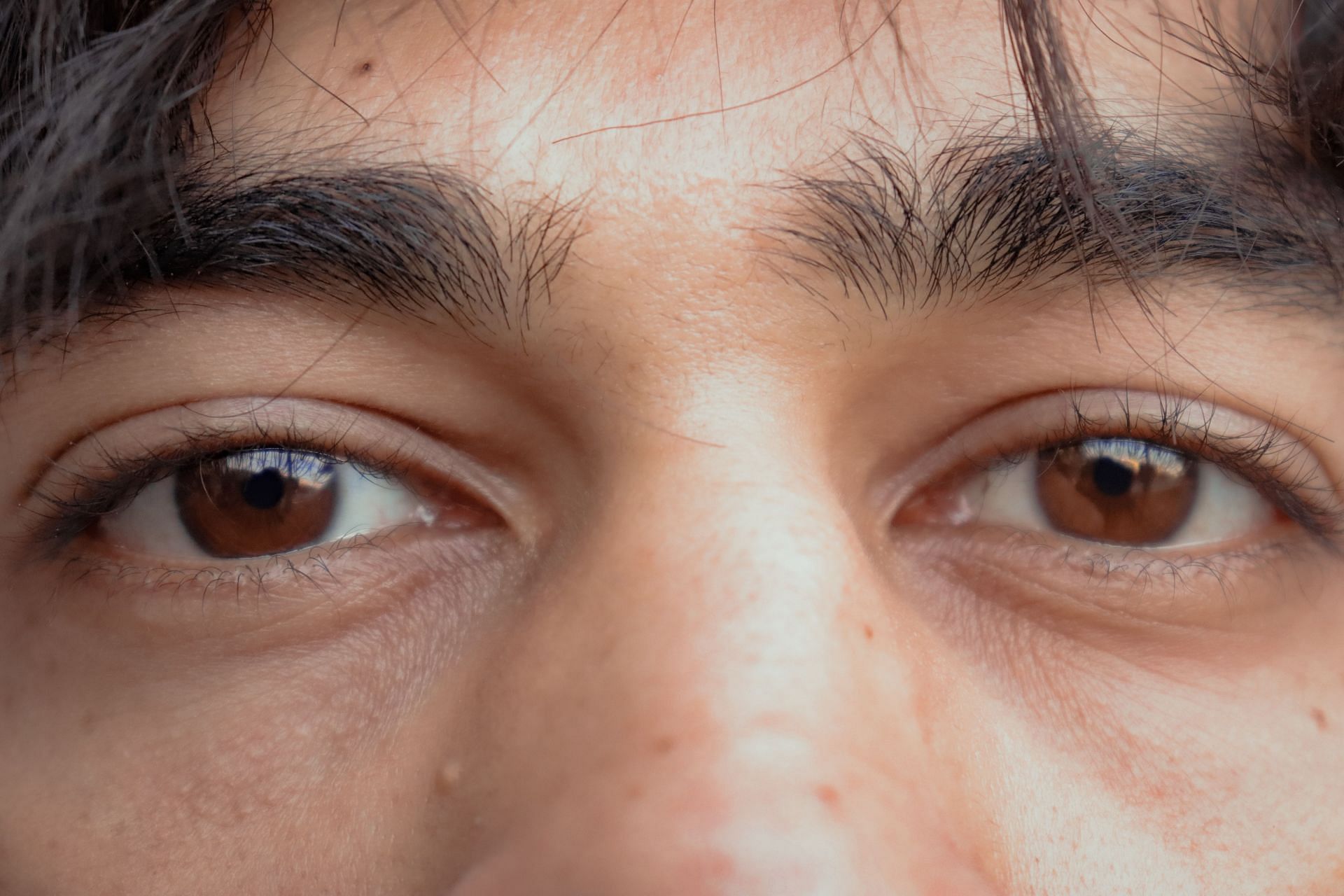 Larger and open pores are more visible to naked eyes. (Image via Pexels/Keith Lobo)