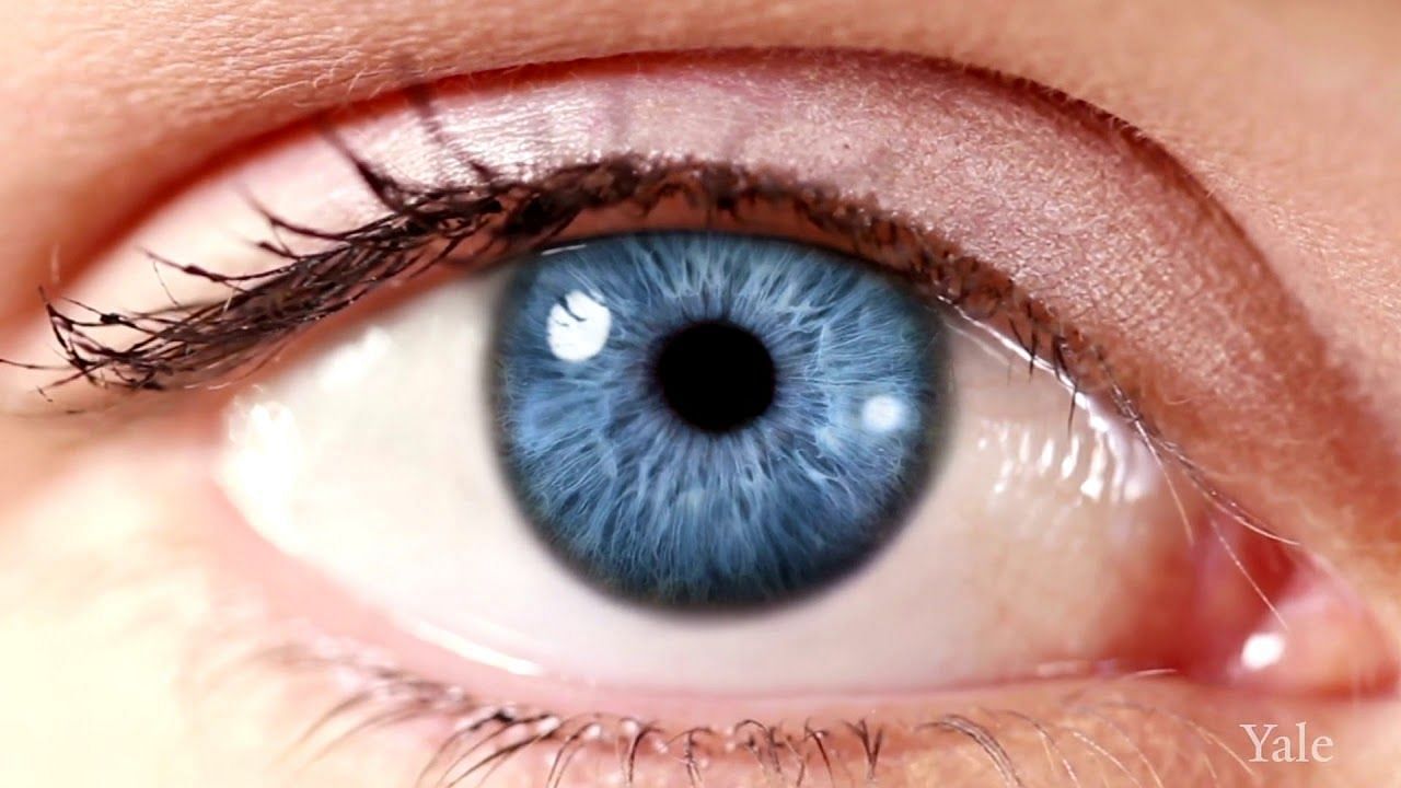 Macular degeneration symptoms gets worse by time (Photo by Yale school of medicine)