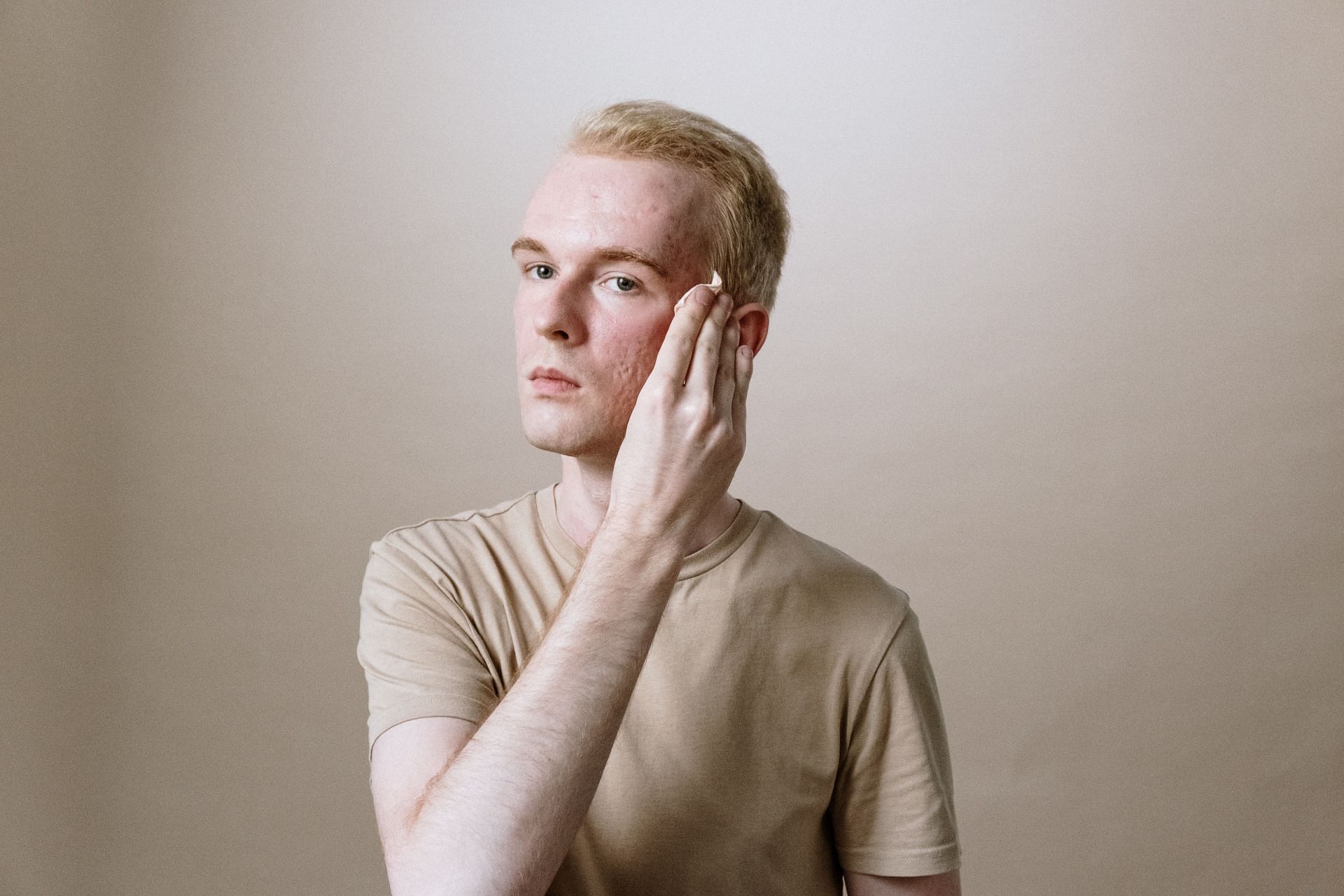 Man wiping his face (Image via Pexels/Cottonbro Studio)