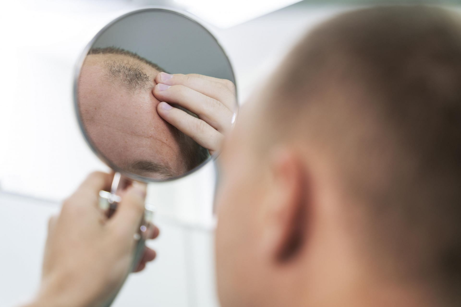 While treatment for scalp eczema is available, many people experience shame in seeking help. (Image via Freepik/ Freepik)