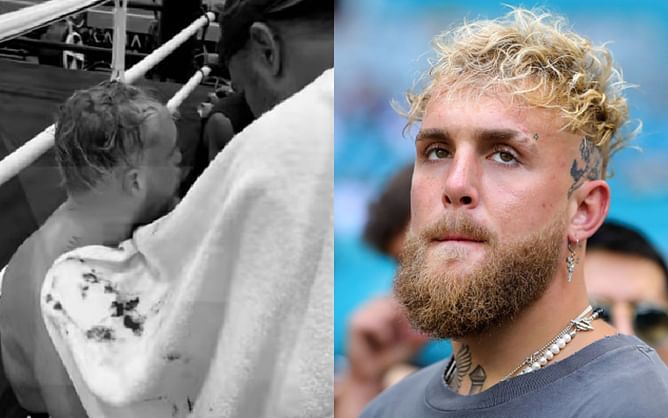 Jake Paul busted open in sparring ahead of Tommy Fury bout