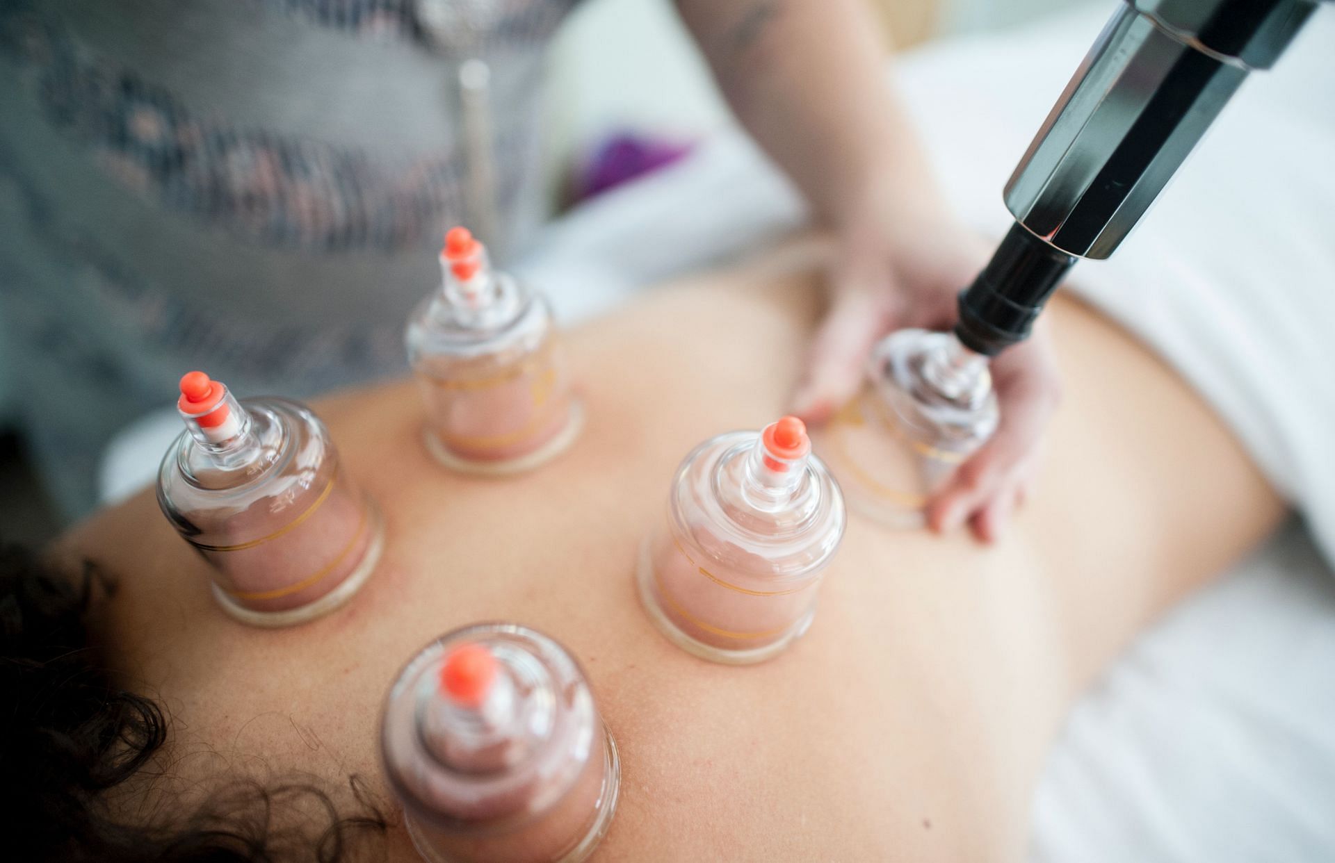 Cupping therapy treat a variety of problems, including stress, pain, allergies, exhaustion, flu. (Image via Unsplash/ Katherine Hanlon)