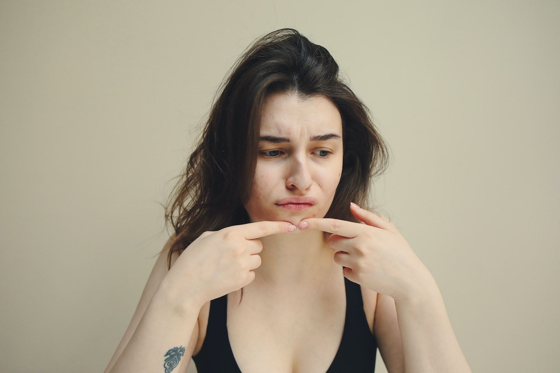 Acne can be caused by poor gut health. (Photo via Pexels/Polina Tankilevitch)