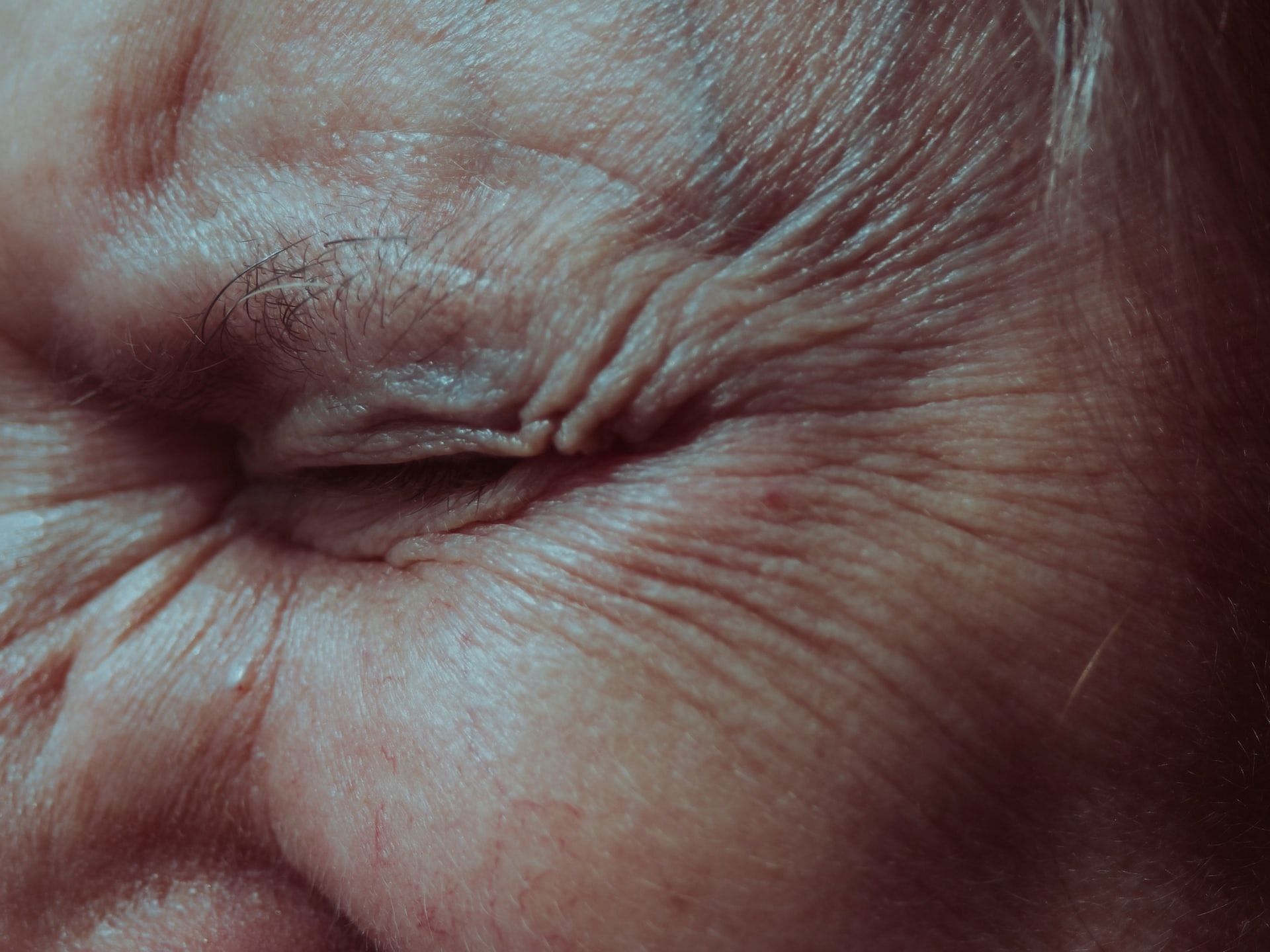 Wrinkles (Photo via Anita Jankovic/Unsplash)