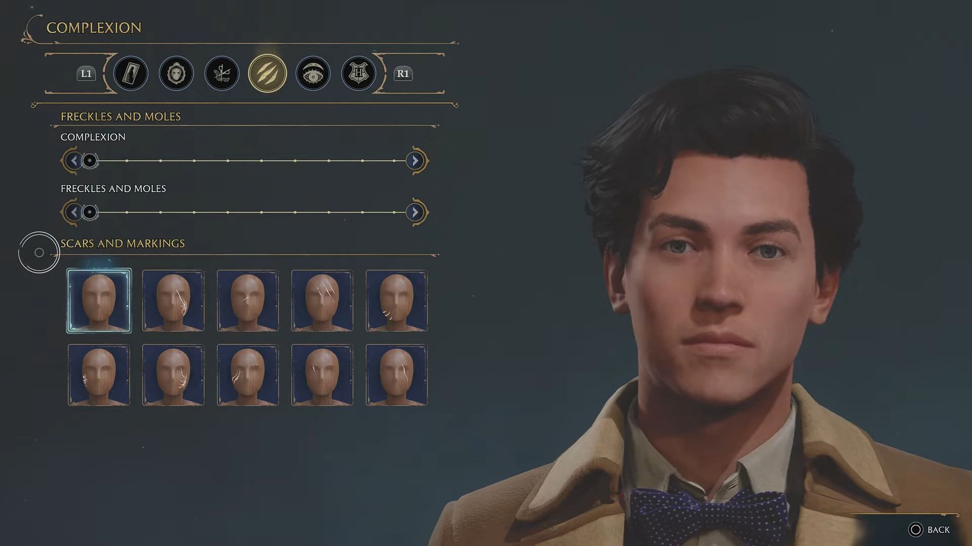 Scars and other facial features in Hogwarts Legacy (Image via Warner Bros Games)