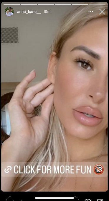 Evander Kane's Ex Wasted No Time Using His Horrific Injury to Promote Her  OnlyFans