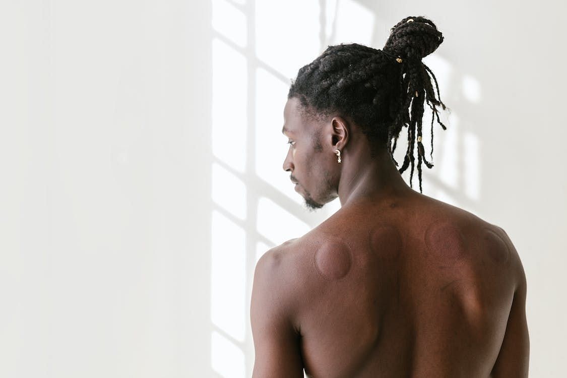 Risks: Health Benefits of Cupping Therapy (Image via Pexels/Rodnae productions)