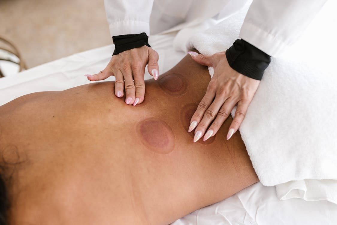 Who should try it: Health Benefits of Cupping Therapy (Image via Pexels/Rodnae productions)